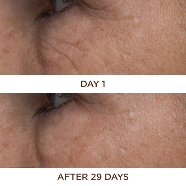 Perricone MD Cold Plasma Plus+ Eye 15ml - Contorno de Ojos Antiedad