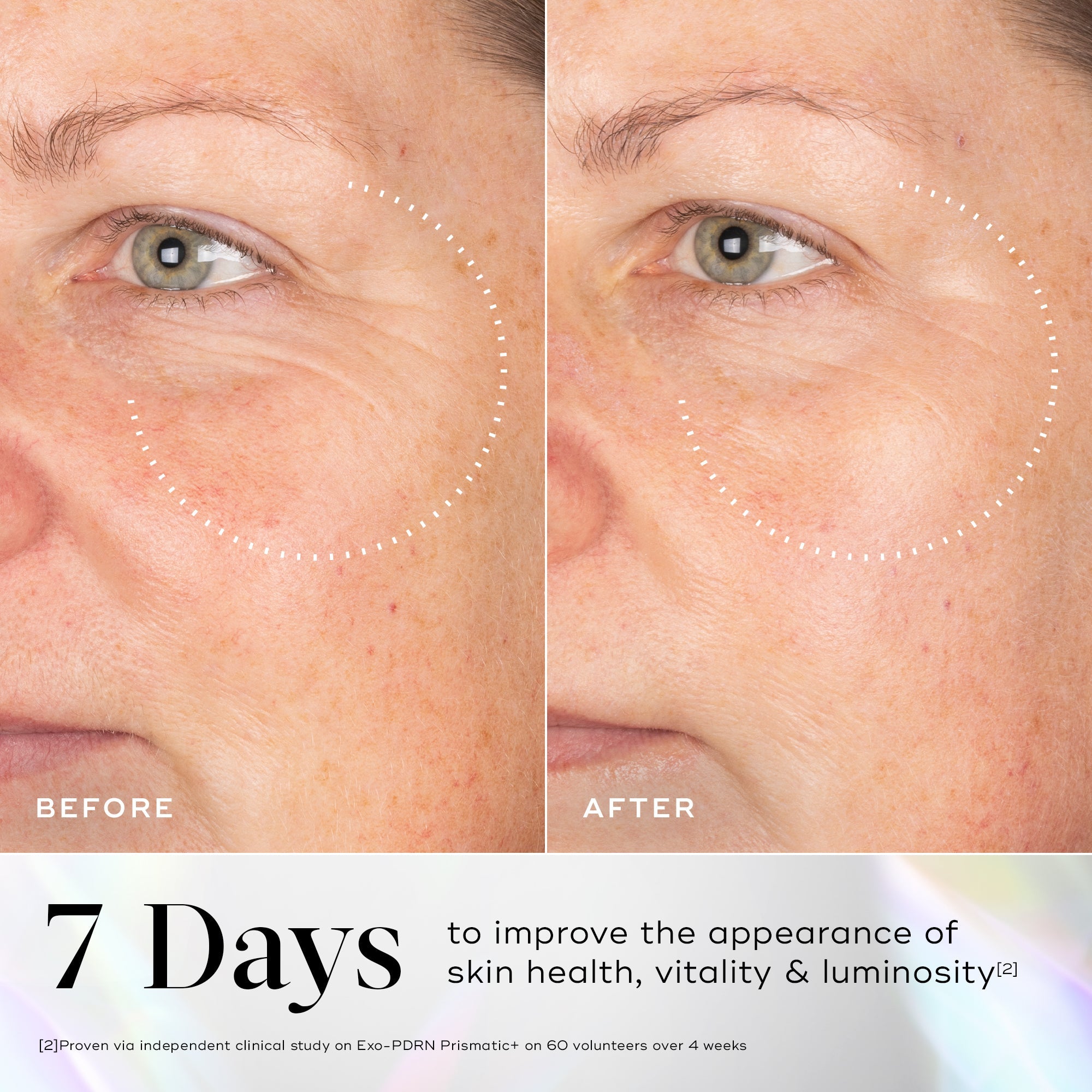 Medik8 EXO-PDRN PRISMÁTIC+ 30ml