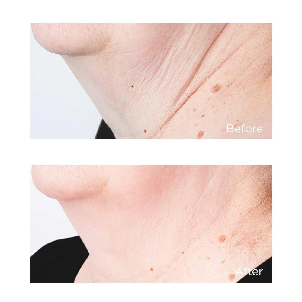 Perricone MD Cold Plasma Plus+ Sub-D/Neck 59ml - Tratamiento Cuello y Escote